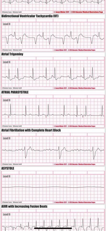 ECG Cardio Illustrations-10
