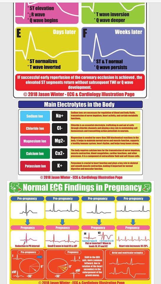 ECG Cardio Illustrations-6